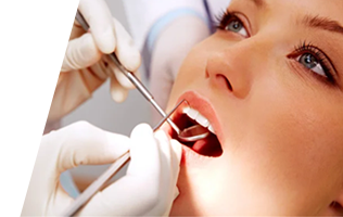 Caplash Dental Veneers & Bonding