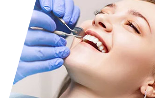 White Fillings Brampton