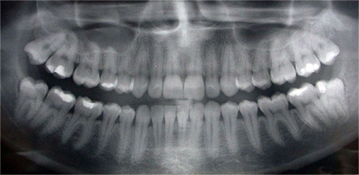 Digital xray Brampton